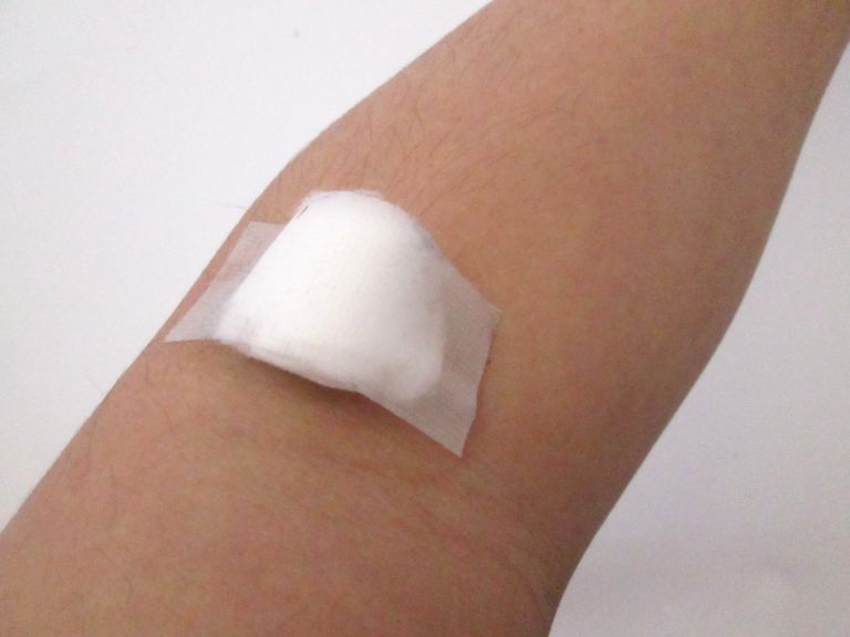 歯科矯正で手に入れる美しい歯並びと一生の健康を考える選択ガイド